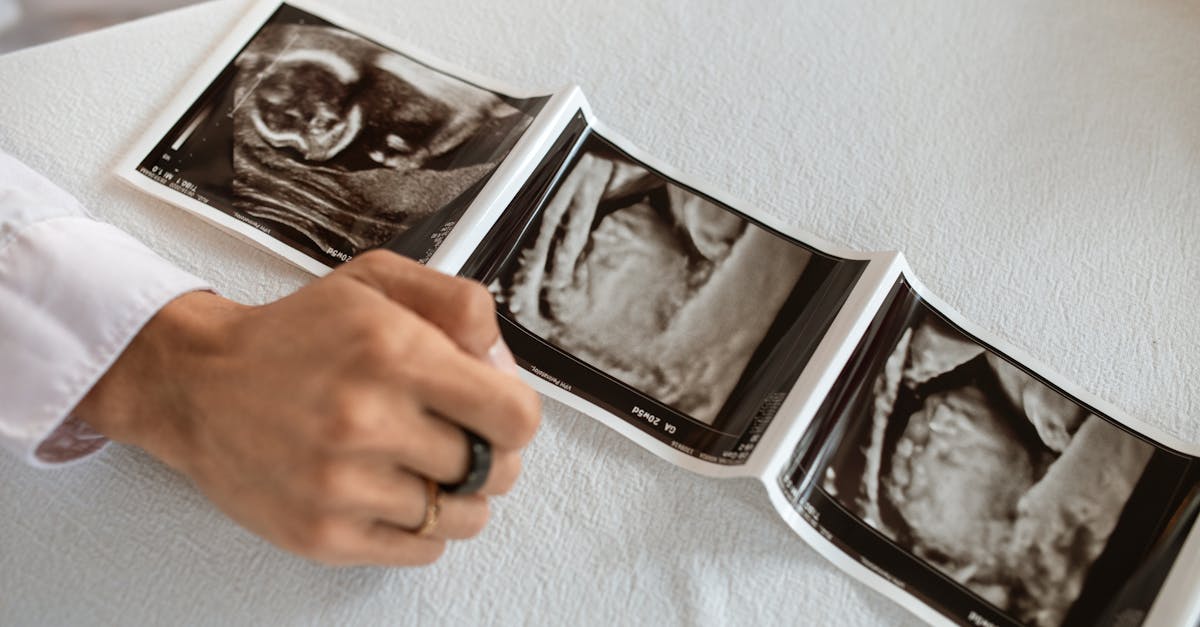 entdecken sie alles rund um familienplanung: beratung, methoden, tipps und wichtige informationen, um selbstbestimmte entscheidungen für ihre zukunft zu treffen. für paare und einzelpersonen, die verantwortungsvoll planen möchten.